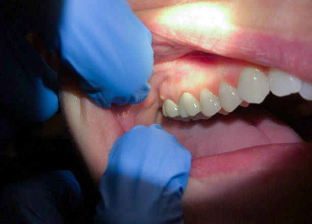 Best After-Hours Emergency Dentist in Fairfax Station, VA